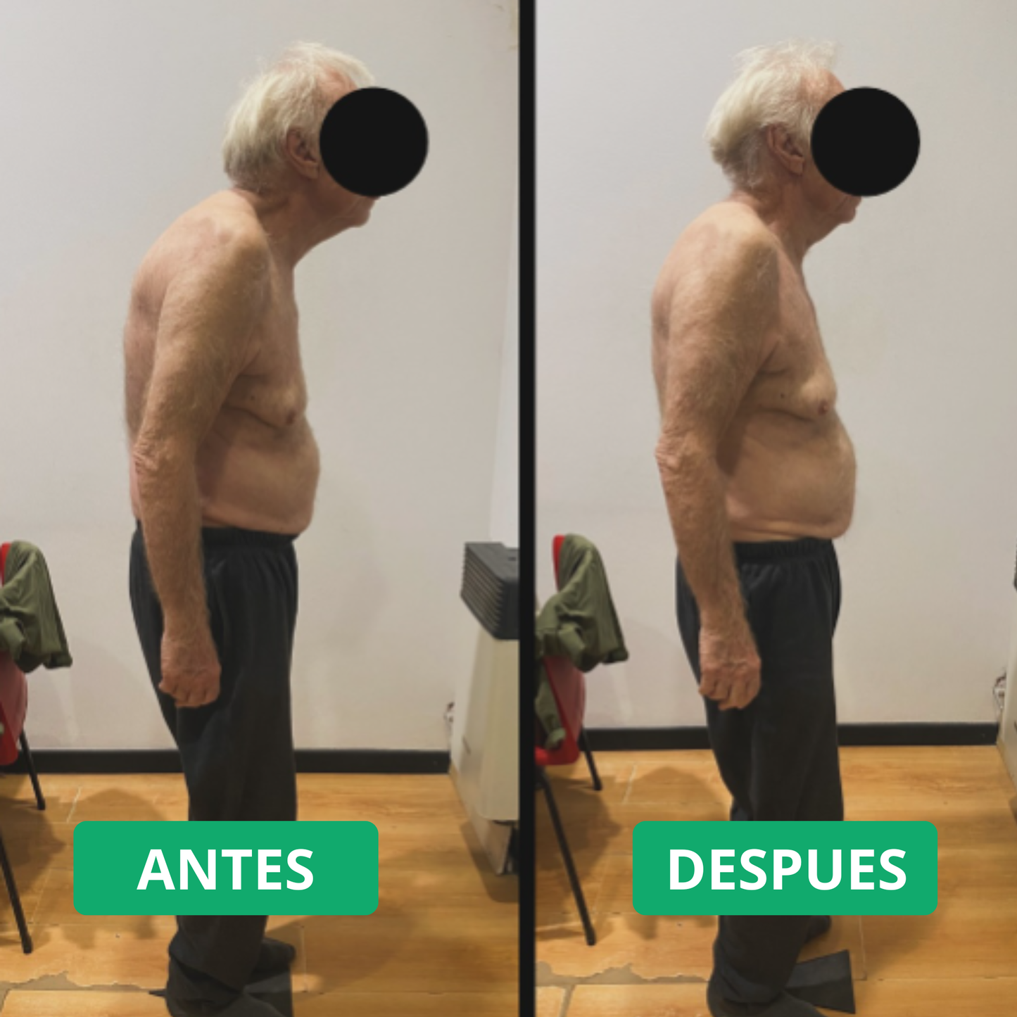 Corrector de Postura Alignora® + Mini-Masajeador (GRATIS) - ULTIMAS UNIDADES