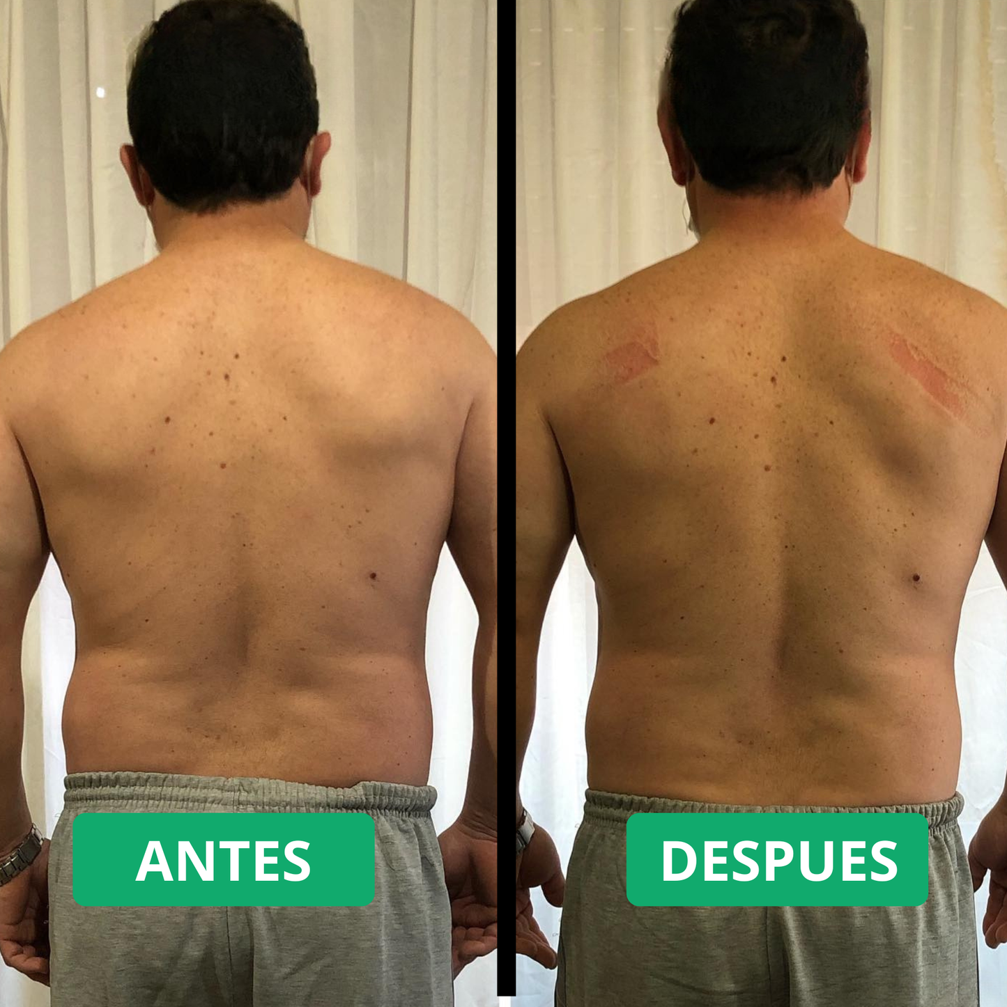 Corrector de Postura Alignora® + Mini-Masajeador (GRATIS) - ULTIMAS UNIDADES