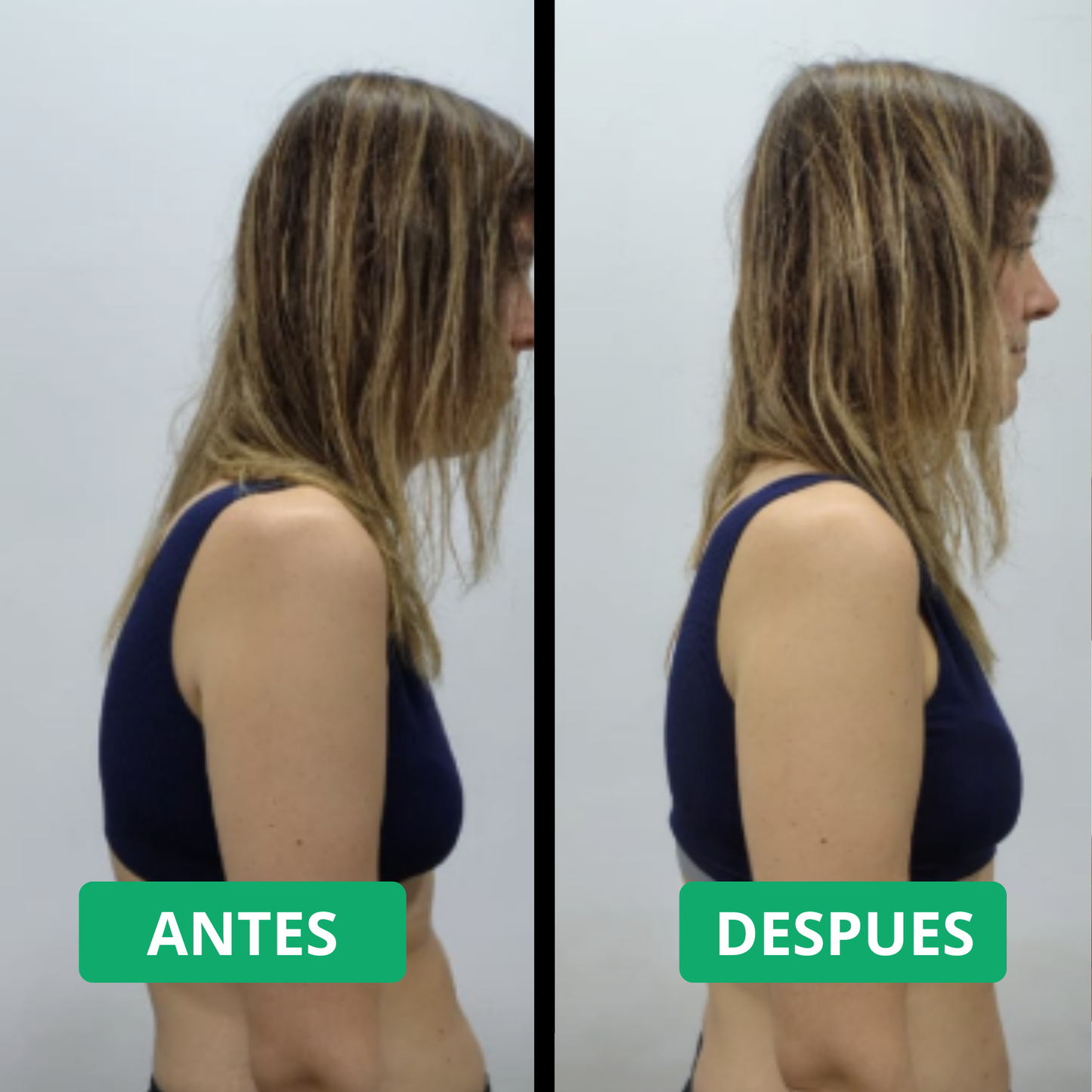 Corrector de Postura Alignora® + Mini-Masajeador (GRATIS) - ULTIMAS UNIDADES